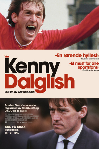 Kenny Dalglish